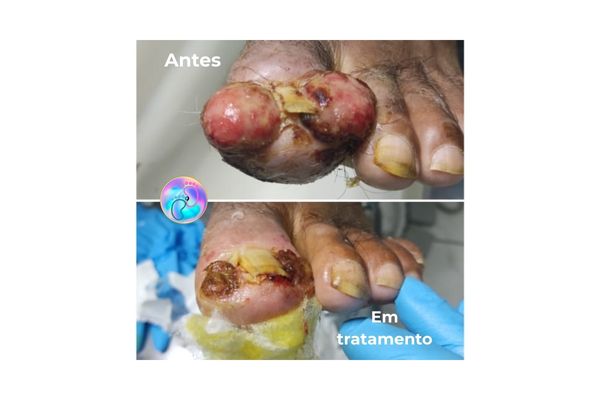 Foto de antes e depois do tratamento 20